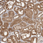 Immunohistochemical staining of human kidney shows moderate cytoplasmic positivity in cells in tubules.