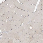 Immunohistochemical staining of human skeletal muscle shows very weak positivity in myocytes.