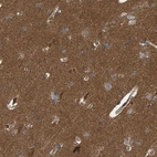 Anti-ATP6V1H Antibody