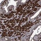 Immunohistochemical staining of human prostate shows strong cytoplasmic positivity in smooth muscle cells.