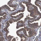 Immunohistochemical staining of human fallopian tube shows strong cytoplasmic positivity in glandular cells.
