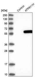 Western blot analysis in control (vector only transfected HEK293T lysate) and ATP6V1H over-expression lysate (Co-expressed with a C-terminal myc-DDK tag (~3.1 kDa) in mammalian HEK293T cells, LY414295).