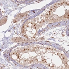 Anti-KLHL36 Antibody