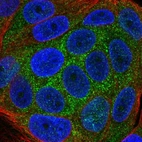 Immunofluorescent staining of human cell line MCF7 shows localization to cytosol.