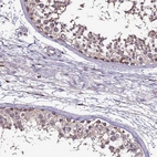 Anti-CEP55 Antibody