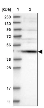 Lane 1: Marker [kDa] 230, 130, 95, 72, 56, 36, 28, 17, 11_br/_Lane 2: Human cell line RT-4