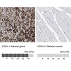 Anti-SGSH Antibody