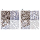 Immunohistochemical staining of human adrenal gland, duodenum, kidney and skeletal muscle using Anti-SGSH antibody HPA023436 (A) shows similar protein distribution across tissues to independent antibody HPA023451 (B).