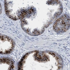 Immunohistochemical staining of human prostate shows strong cytoplasmic granular positivity in glandular cells.