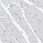 Immunohistochemical staining of human skeletal muscle shows very weak positivity in myocytes as expected.