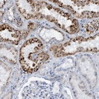 Immunohistochemical staining of human kidney shows strong cytoplasmic granular positivity in cells in tubules.