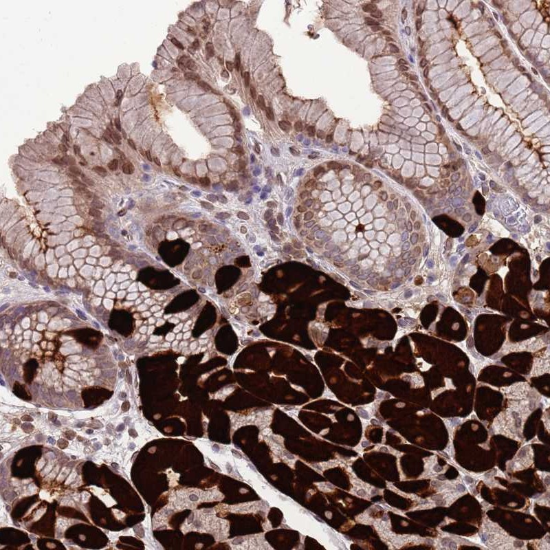 Anti-ZNF665 Antibody