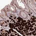 Anti-ZNF665 Antibody