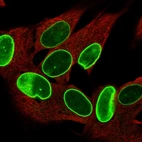Immunofluorescent staining of human cell line SH-SY5Y shows localization to nuclear membrane.