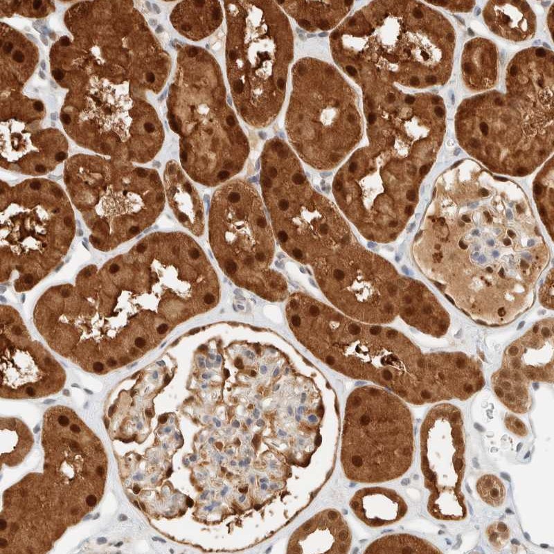 Anti-ZBTB37 Antibody