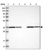 Lane 1: Marker [kDa] 230, 130, 95, 72, 56, 36, 28, 17, 11_br/_Lane 2: Human cell line RT-4_br/_Lane 3: Human cell line U-251MG sp_br/_Lane 4: Human plasma (IgG/HSA depleted)_br/_Lane 5: Human liver tissue_br/_Lane 6: Human tonsil tissue