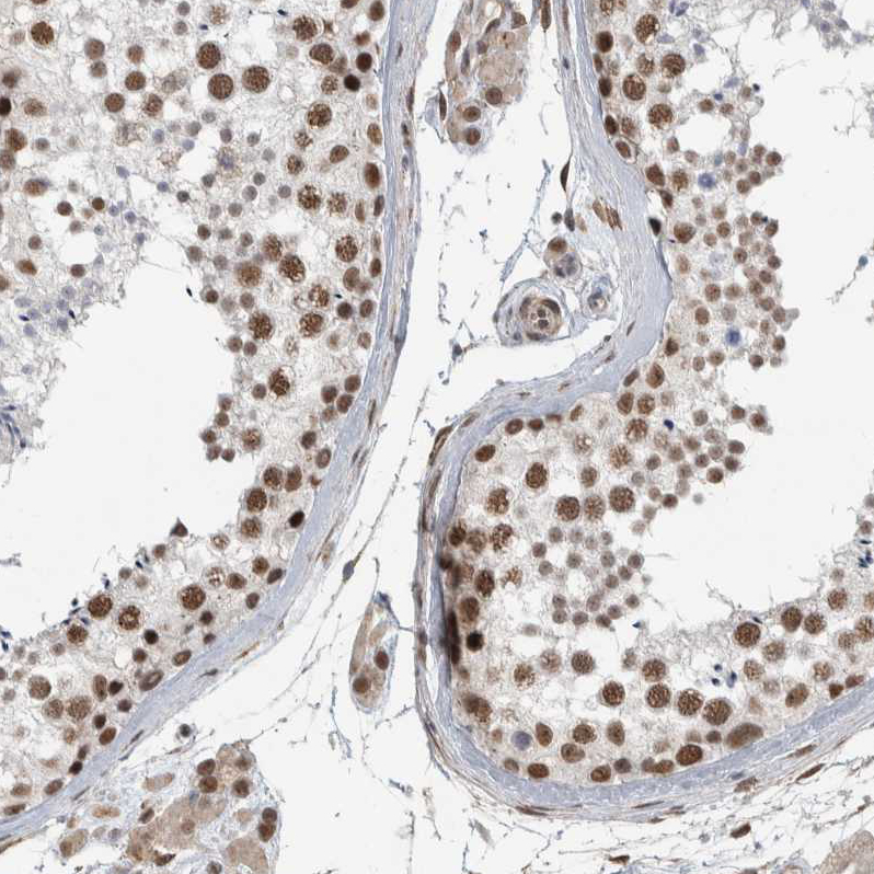 Anti-DDX42 Antibody