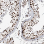 Anti-DDX42 Antibody