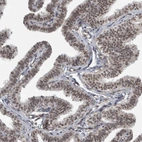 Immunohistochemical staining of human fallopian tube shows moderate nuclear positivity in glandular cells.