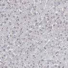 Immunohistochemical staining of human liver shows weak nuclear positivity in hepatocytes.