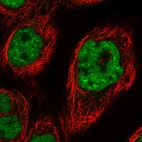 Immunofluorescent staining of human cell line A-431 shows localization to nuclear speckles.