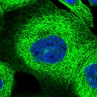 Immunofluorescent staining of human cell line A-431 shows localization to microtubules.
