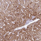 Anti-ZNF101 Antibody