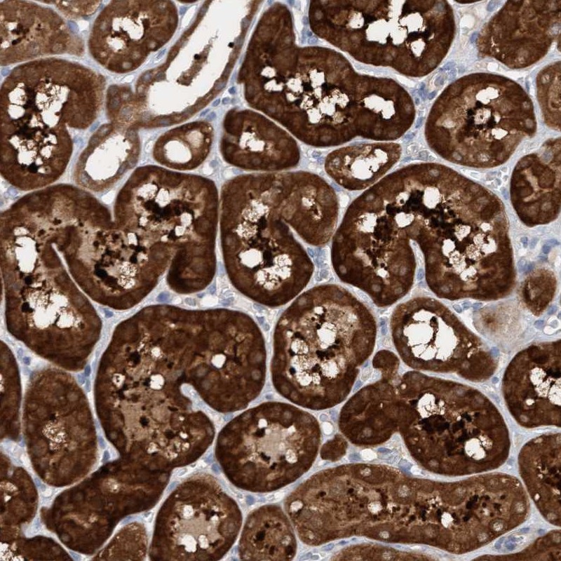 Anti-KLHL25 Antibody