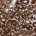 Anti-KLHL25 Antibody