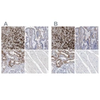 Immunohistochemical staining of human adrenal gland, duodenum, kidney and skeletal muscle using Anti-SGSH antibody HPA023451 (A) shows similar protein distribution across tissues to independent antibody HPA023436 (B).