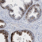 Immunohistochemical staining of human prostate shows strong cytoplasmic granular positivity in glandular cells.