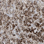Immunohistochemical staining of human adrenal gland shows strong cytoplasmic granular positivity in glandular cells.