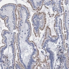 Immunohistochemical staining of human duodenum shows strong cytoplasmic granular positivity in glandular cells.