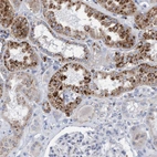 Immunohistochemical staining of human kidney shows strong cytoplasmic granular positivity in cells in tubules.