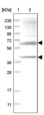 Lane 1: Marker [kDa] 230, 130, 95, 72, 56, 36, 28, 17, 11_br/_Lane 2: Human cell line RT-4