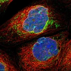 Immunofluorescent staining of human cell line A-431 shows positivity in nuclear membrane & mitochondria.