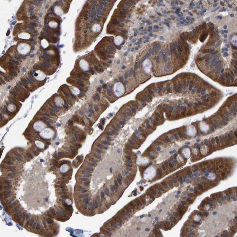Anti-TRIM68 Antibody