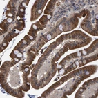 Anti-TRIM68 Antibody