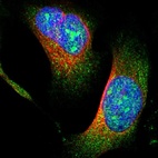 Immunofluorescent staining of human cell line U-2 OS shows positivity in nucleus, nucleoli & cytoplasm.