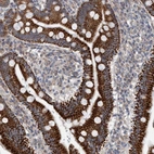 Anti-ZNF566 Antibody