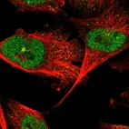 Immunofluorescent staining of human cell line U-251 MG shows localization to nucleus.