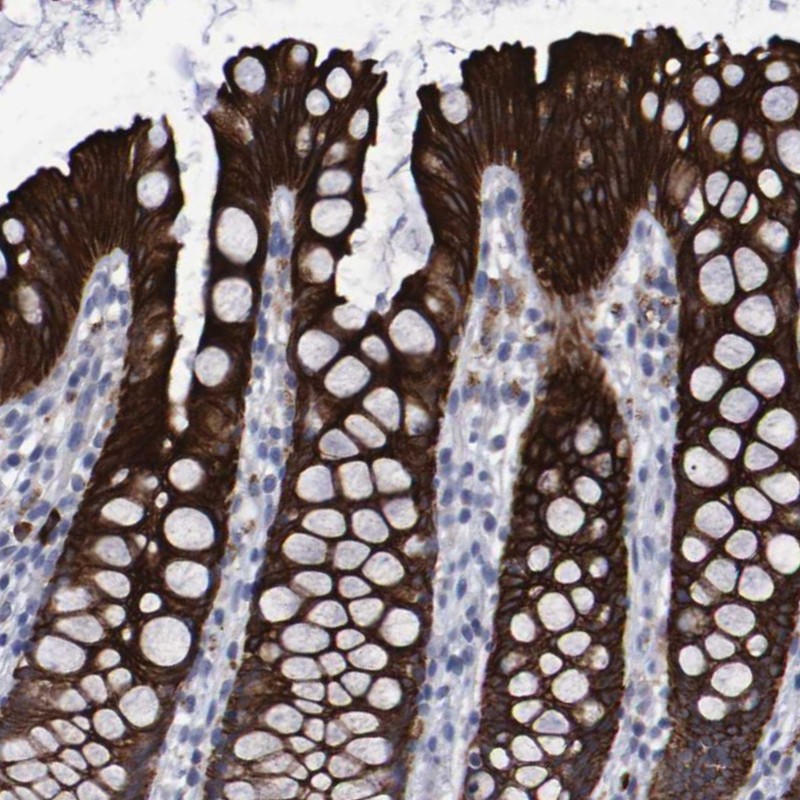 Anti-CCDC144NL Antibody