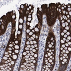 Anti-CCDC144NL Antibody