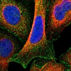 Immunofluorescent staining of human cell line U-2 OS shows localization to nucleus & plasma membrane.