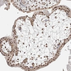 Immunohistochemical staining of human placenta shows moderate nuclear positivity in trophoblastic cells.