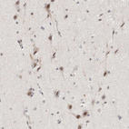 Immunohistochemical staining of human cerebral cortex shows moderate nuclear positivity in neurons.
