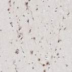 Immunohistochemical staining of human cerebral cortex shows moderate nuclear positivity in neurons.