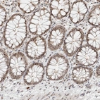 Immunohistochemical staining of human rectum shows weak to moderate nuclear positivity in glandular cells.