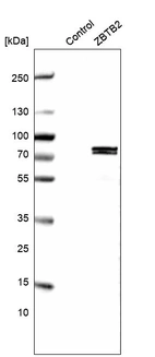 Western blot analysis in control (vector only transfected HEK293T lysate) and ZBTB2 over-expression lysate (Co-expressed with a C-terminal myc-DDK tag (~3.1 kDa) in mammalian HEK293T cells, LY412230).