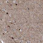 Anti-AGAP2 Antibody